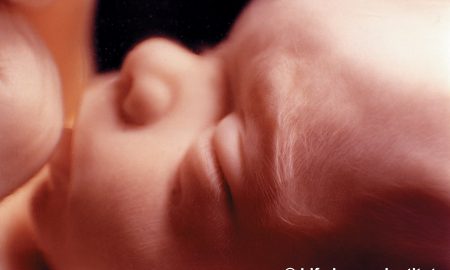 abortions,abortion, late-term, aborted, baby olivia, viability