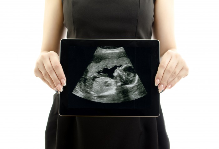 ultrasound, silent scream, preborn