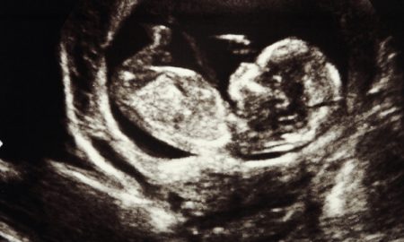 fetal tissue