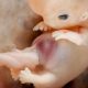 first trimester, polish bishops, abortion pill, 8 weeks, abortion procedures videos, heartbeat, fetus, embryo, south carolina, poland