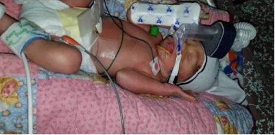Baby Maribel is alive because her mother refused abortion despite the risks to her health