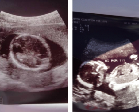 abortion, Planned Parenthood