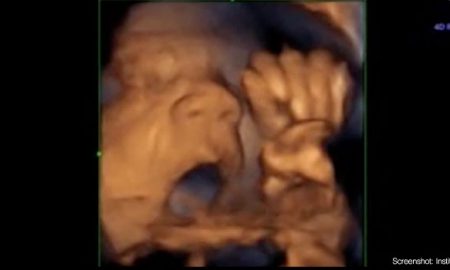 preborn baby