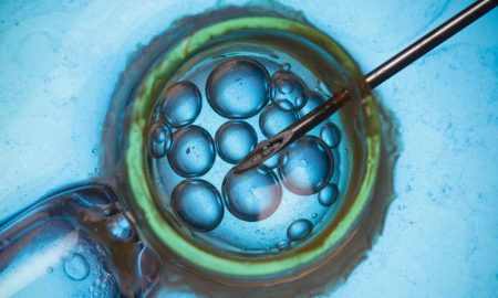 IVF, embryo