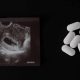 abortion pill, Israel abortion, georgia