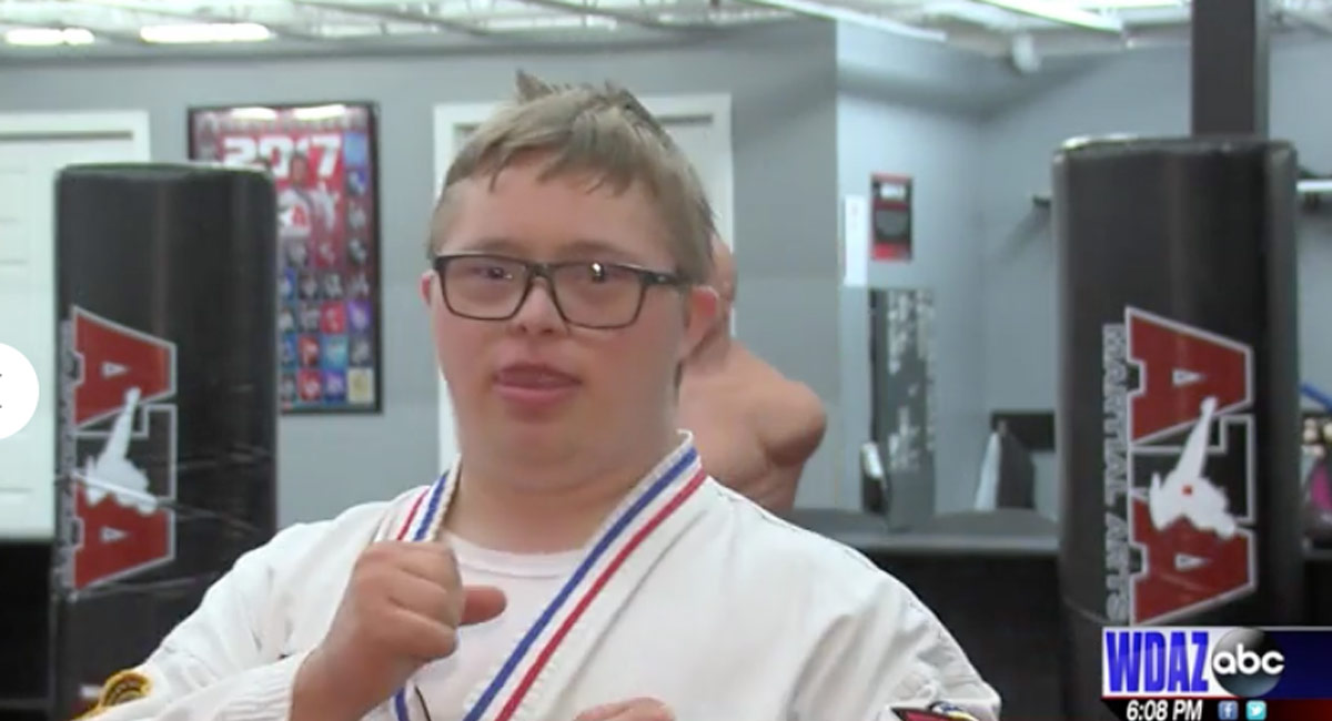 Down syndrome