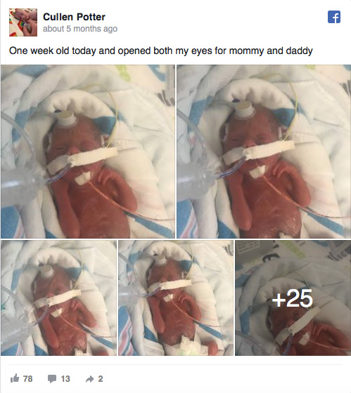 premature