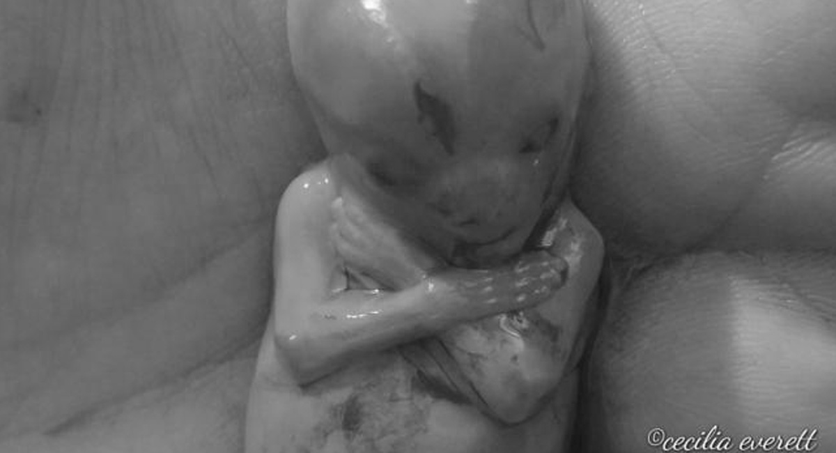miscarried