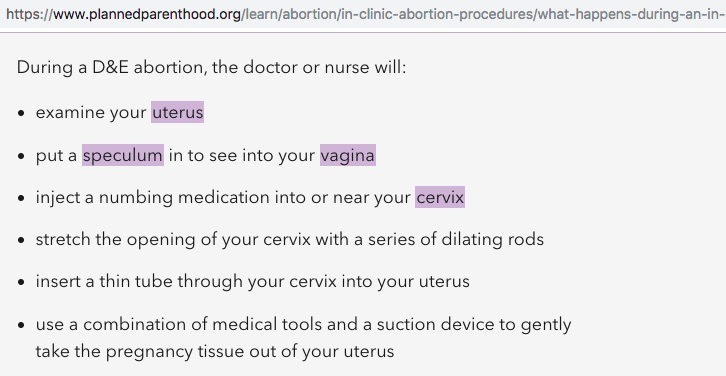 Not the full facts - Planned Parenthood D&E Abortion