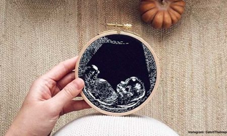 ultrasound
