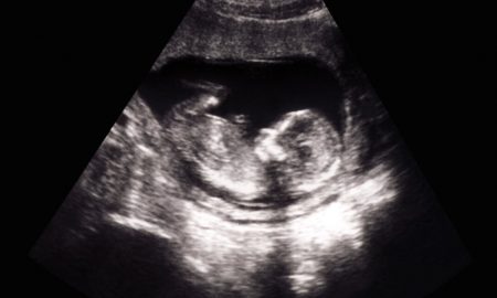 pro-life, Georgia heartbeat, abortion restrictions