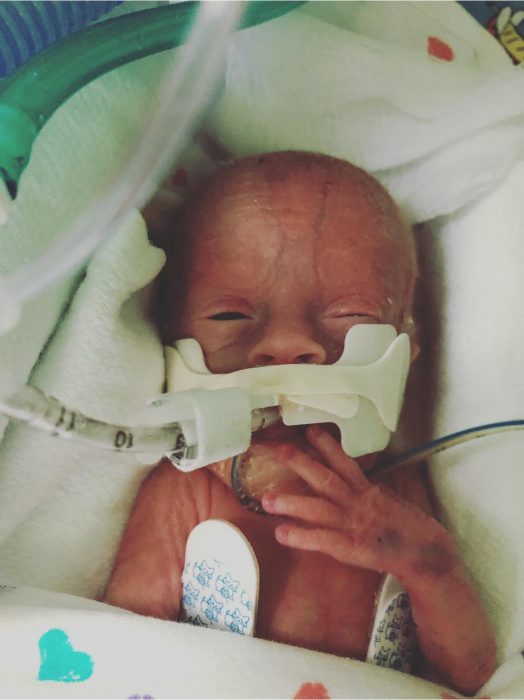 preemie