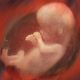 aborted, science, heartbeat