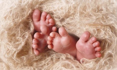 twins, conjoined twins, abortion, preamture, babies, embryos