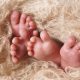 twins, conjoined twins, abortion, preamture, babies, embryos