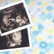 ultrasound, aborted, late-term, abortions