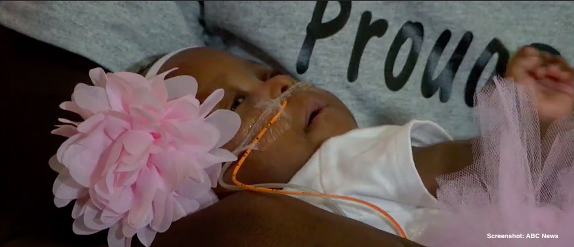 preemie