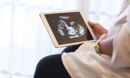 anencephaly, northern ireland,, Arizona, abortion, Biden
