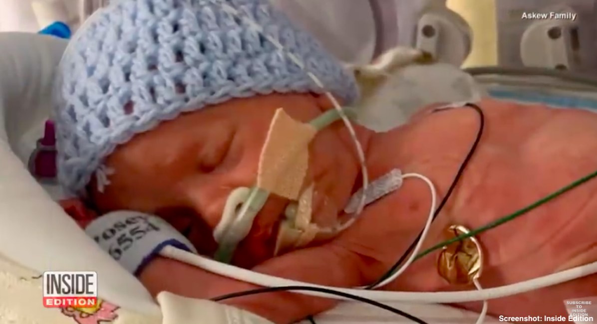 preemie, NICU