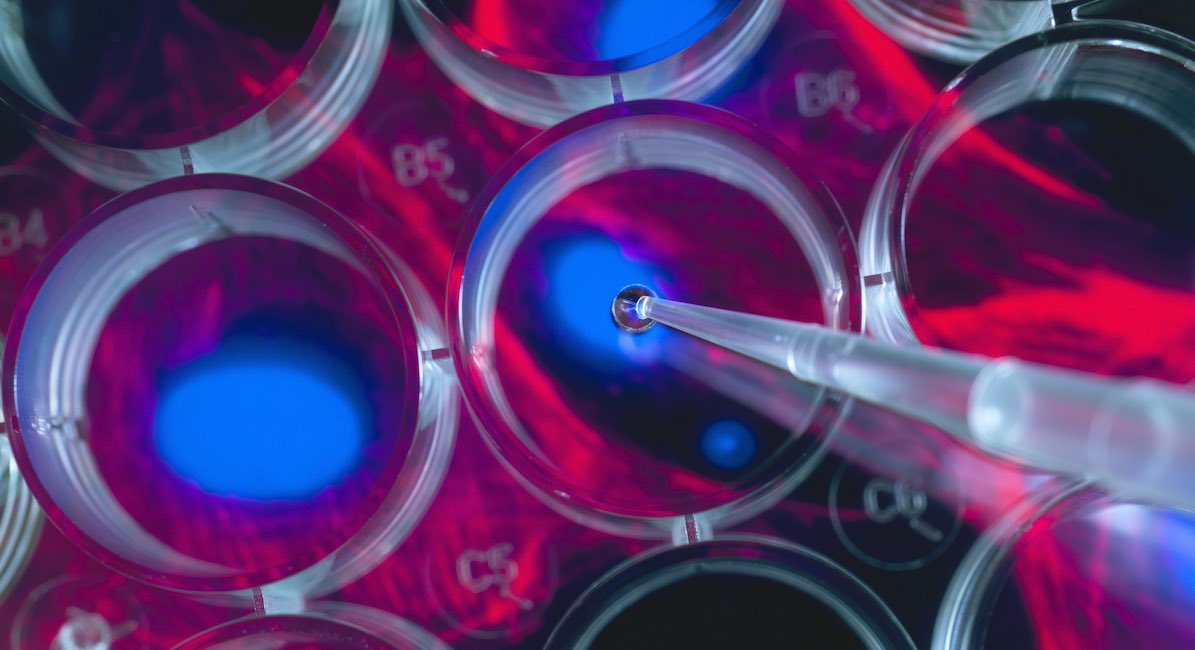 stem cell