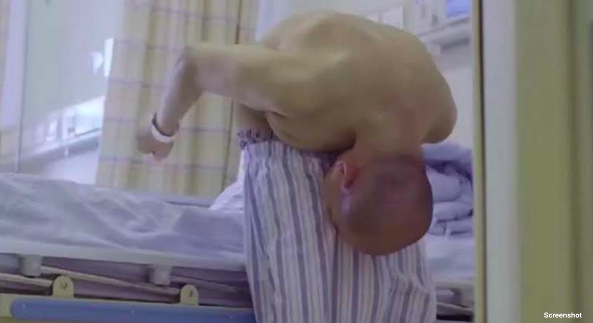 folded man, China, surgery