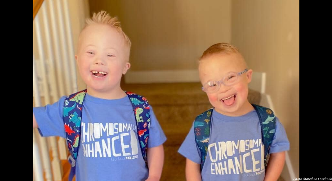 Down syndrome