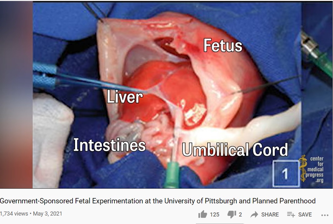 Image: University of Pittsburgh uses live aborted babies in study (Image: Center for Medical Progress video)
