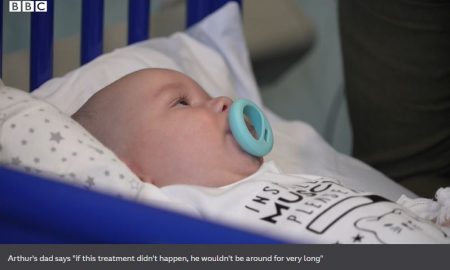 SMA, spinal muscular atrophy