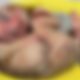 partial-birth abortion, abortion