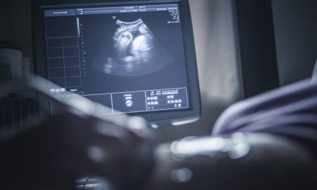 ultrasound, abortion, Polish