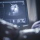 ultrasound, abortion, Polish