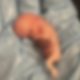 abortion, abortion pill