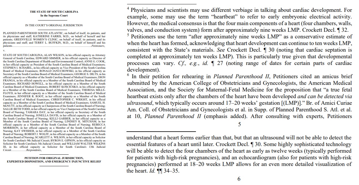 South Carolina lawsuit by Planned Parenthood footnotes on fetal heartbeat