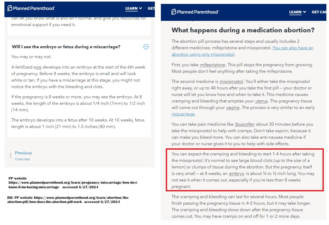 Planned Parenthood deceptive description of seeing the baby or embryo miscarriage v abortion pill