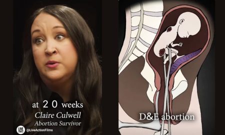 Face to Face, fetal pain